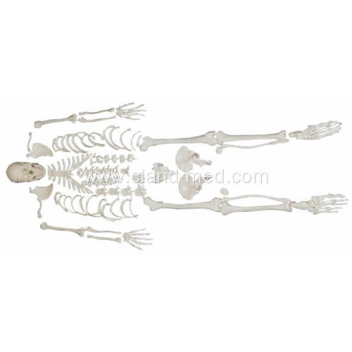 Disarticulated Skeleton with Skull